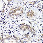 IMPDH2 Polyclonal Antibody