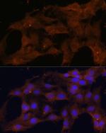 BAX Antibody in Immunocytochemistry (ICC/IF)