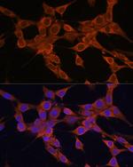 BAX Antibody in Immunocytochemistry (ICC/IF)