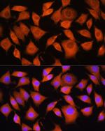 BAX Antibody in Immunocytochemistry (ICC/IF)