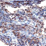 BAX Antibody in Immunohistochemistry (Paraffin) (IHC (P))