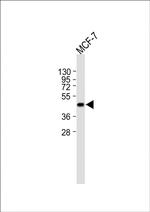 TSG101 Antibody in Western Blot (WB)