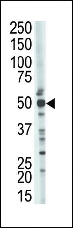 TSG101 Antibody in Western Blot (WB)