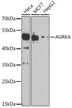 Aurora A Polyclonal Antibody