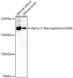 A2M Polyclonal Antibody