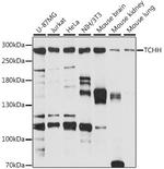 TCHH Polyclonal Antibody