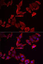 SKAP2 Polyclonal Antibody