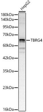 TBRG4 Antibody in Western Blot (WB)