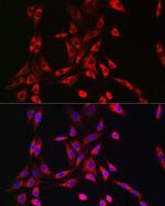 PIK3R4 Antibody in Immunocytochemistry (ICC/IF)