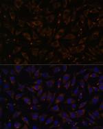 PLLP Polyclonal Antibody