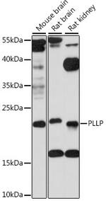 PLLP Antibody in Western Blot (WB)