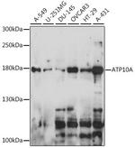 ATP10A Polyclonal Antibody
