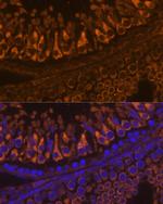 ELSPBP1 Antibody in Immunohistochemistry (Paraffin) (IHC (P))