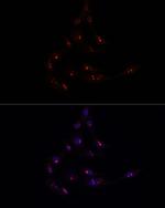 METT10D Polyclonal Antibody