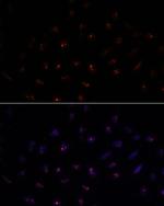 METT10D Antibody in Immunocytochemistry (ICC/IF)