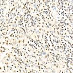 METT10D Antibody in Immunohistochemistry (Paraffin) (IHC (P))