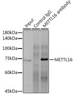 METT10D Antibody in Immunoprecipitation (IP)