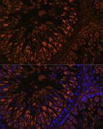 FER1L5 Antibody in Immunohistochemistry (Paraffin) (IHC (P))