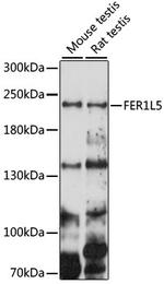 FER1L5 Antibody in Western Blot (WB)