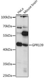 GPR139 Polyclonal Antibody