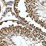 ZNF384 Antibody in Immunohistochemistry (Paraffin) (IHC (P))