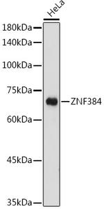 ZNF384 Antibody in Western Blot (WB)