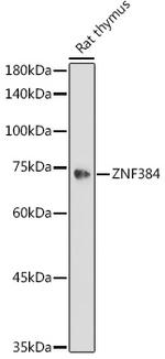 ZNF384 Antibody in Western Blot (WB)