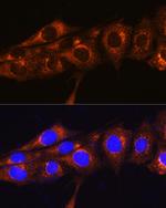 FREM2 Polyclonal Antibody
