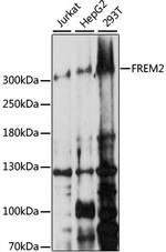 FREM2 Antibody in Western Blot (WB)