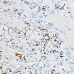 BOLA3 Polyclonal Antibody
