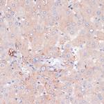 ZNRF3 Antibody in Immunohistochemistry (Paraffin) (IHC (P))