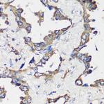 Cyclin B1 Antibody in Immunohistochemistry (Paraffin) (IHC (P))