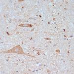 VAChT Polyclonal Antibody