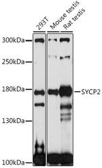 SYCP2 Antibody in Western Blot (WB)