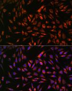 EML4 Antibody in Immunocytochemistry (ICC/IF)
