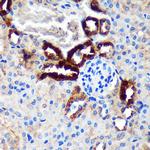 EML4 Antibody in Immunohistochemistry (Paraffin) (IHC (P))