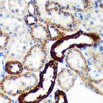 EML4 Antibody in Immunohistochemistry (Paraffin) (IHC (P))