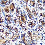 EML4 Antibody in Immunohistochemistry (Paraffin) (IHC (P))