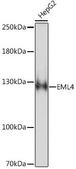 EML4 Antibody in Western Blot (WB)