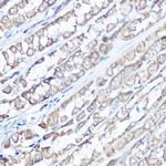 TRPV6 Polyclonal Antibody