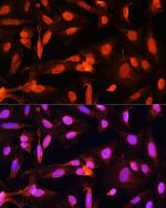 SGOL1 Polyclonal Antibody