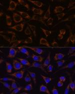 GTPBP8 Polyclonal Antibody