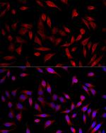 ACSL1 Antibody in Immunocytochemistry (ICC/IF)