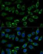 ALDH3A2 Polyclonal Antibody