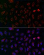 MCU Antibody in Immunocytochemistry (ICC/IF)