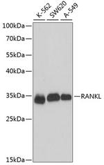 CD254 (RANK Ligand) Antibody in Western Blot (WB)