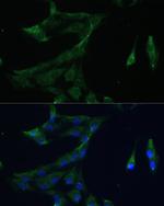 ARL3 Antibody in Immunocytochemistry (ICC/IF)