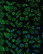 ARL3 Polyclonal Antibody