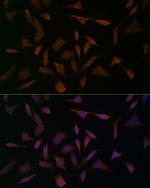 BCAT1 Antibody in Immunocytochemistry (ICC/IF)