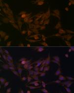 BCAT1 Antibody in Immunocytochemistry (ICC/IF)